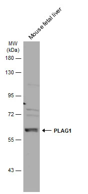 PLAG1 antibody